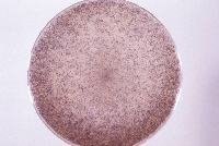 Rhizopus sp.